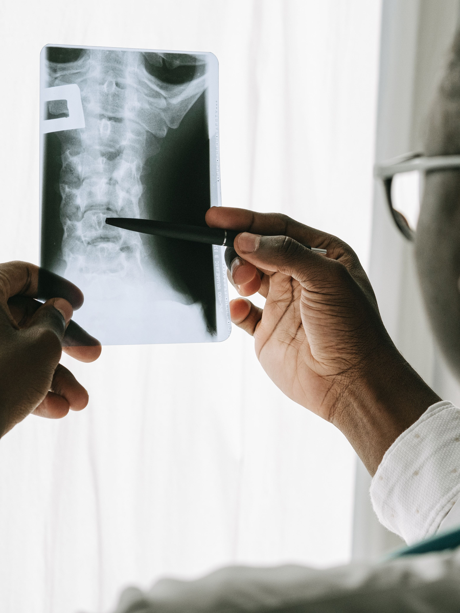 Healthcare professional reviewing a spinal X-ray